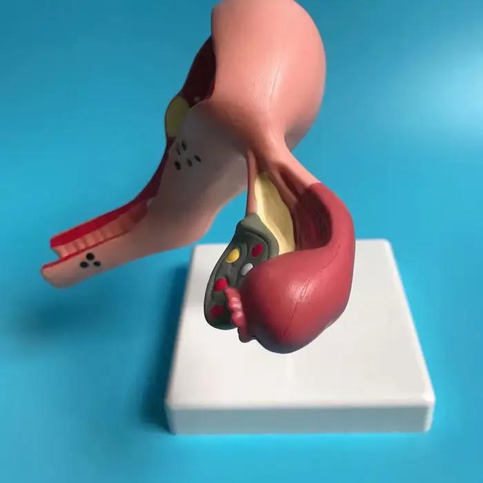 Nouveau modèle de ovaire d'utérus pathologique humain, Structure de Section transversale, modèle d'anatomie anatomique de l'utérus, outil d'enseignement des organes féminins