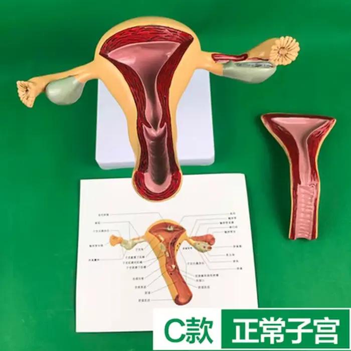 Modèle de dissection de la maladie de l'ovaire et de l'utérus féminin, atoologie, enseignement des aides médicales humaines, anatomie, lésion, utérus