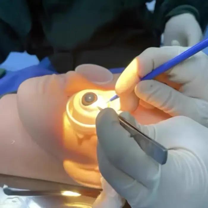 Formation de réparation capsuleuse de la cataracte et modèle de recherche ophtalmique, pratique de Simulation oculaire, modèle de Stent de chirurgie de la cataracte