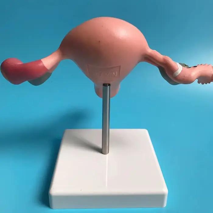 Nouveau modèle de ovaire d'utérus pathologique humain, Structure de Section transversale, modèle d'anatomie anatomique de l'utérus, outil d'enseignement des organes féminins